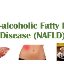 Non-Alcoholic Fatty Liver Disease, Risk Factors, Symptoms (ex. Fatigue), Treatment (ex. Coffee)
