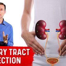 Top Remedies for a UTI (Urinary Tract Infection: Updated)