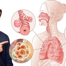 The BEST Remedy for Your Lungs (Infection, Asthma, and COPD)